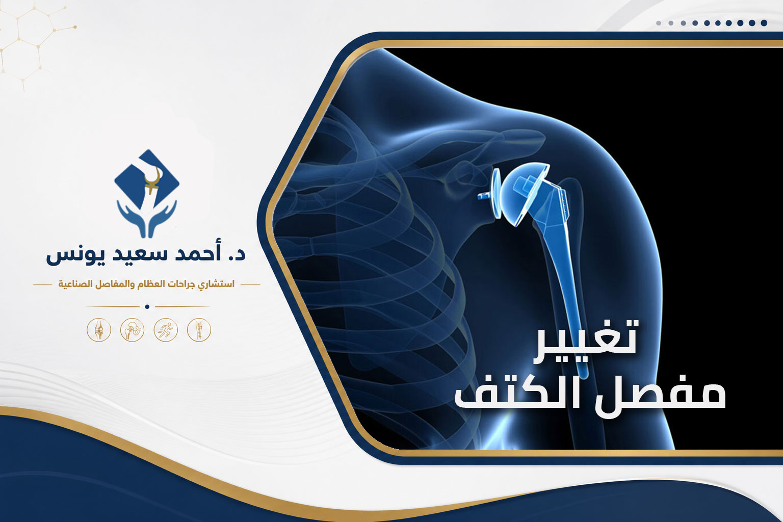تغيير-مفصل-الكتف تغيير مفصل الكتف