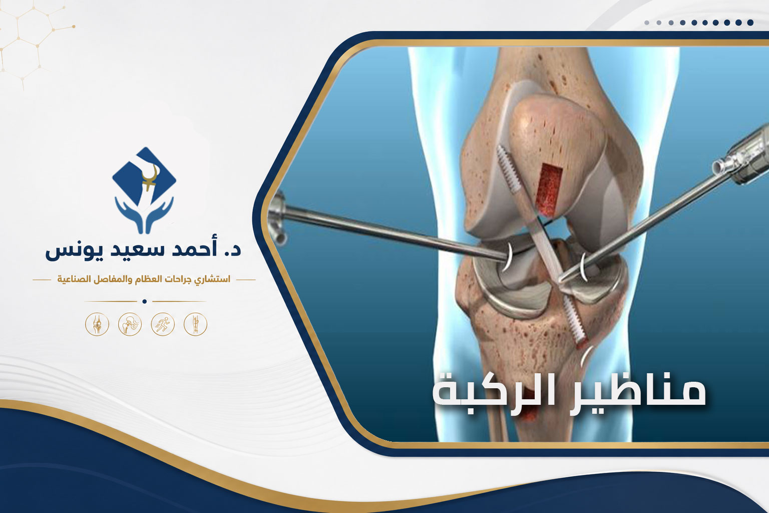 مناظير الركبة