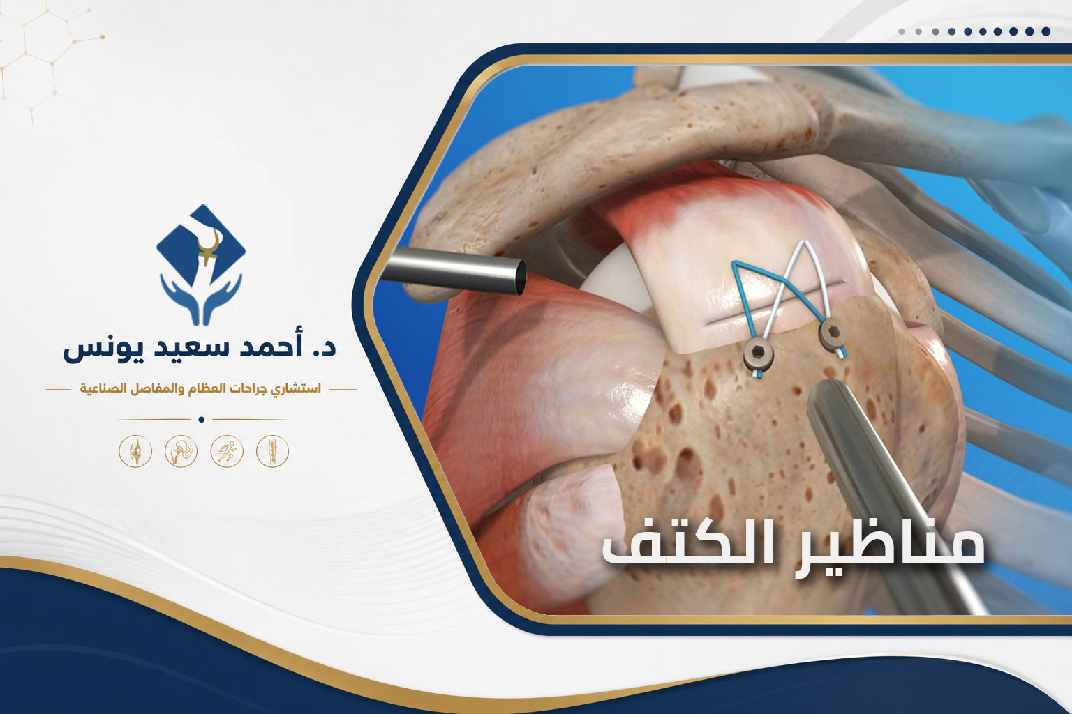 مناظير الكتف