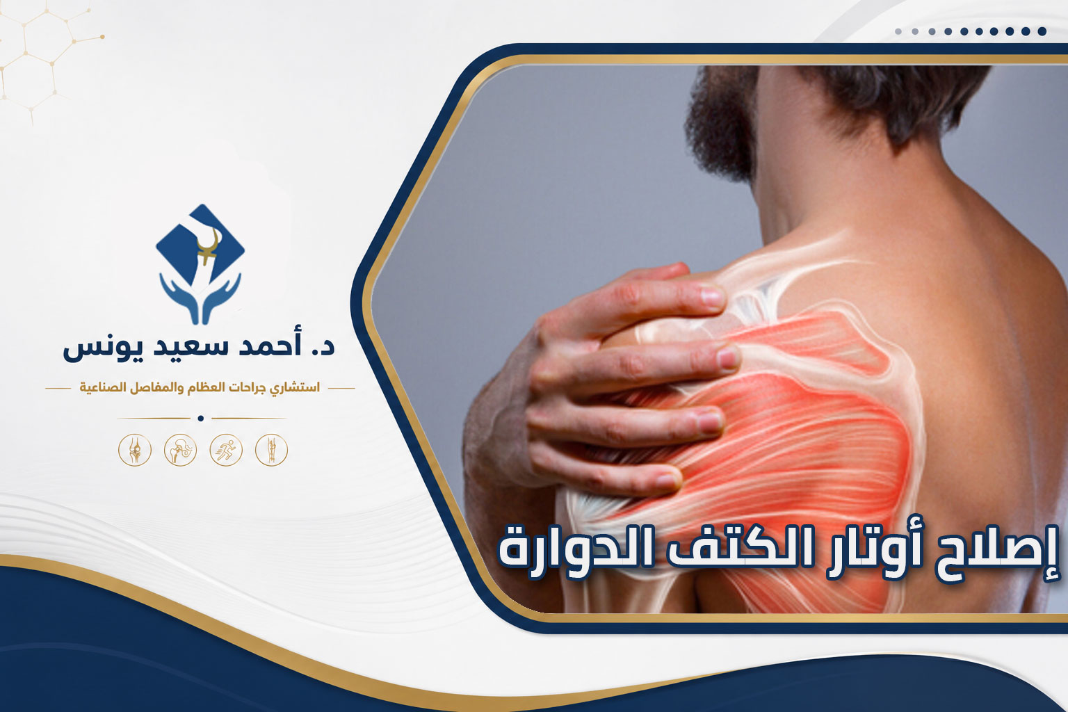 اصلاح أوتار الكتف الدوارة