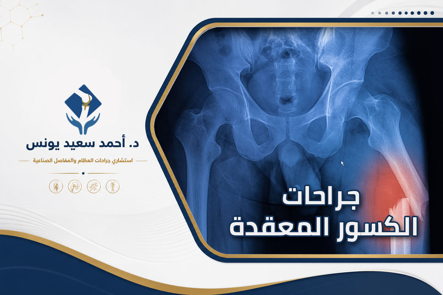 جراحات الكسور المعقدة