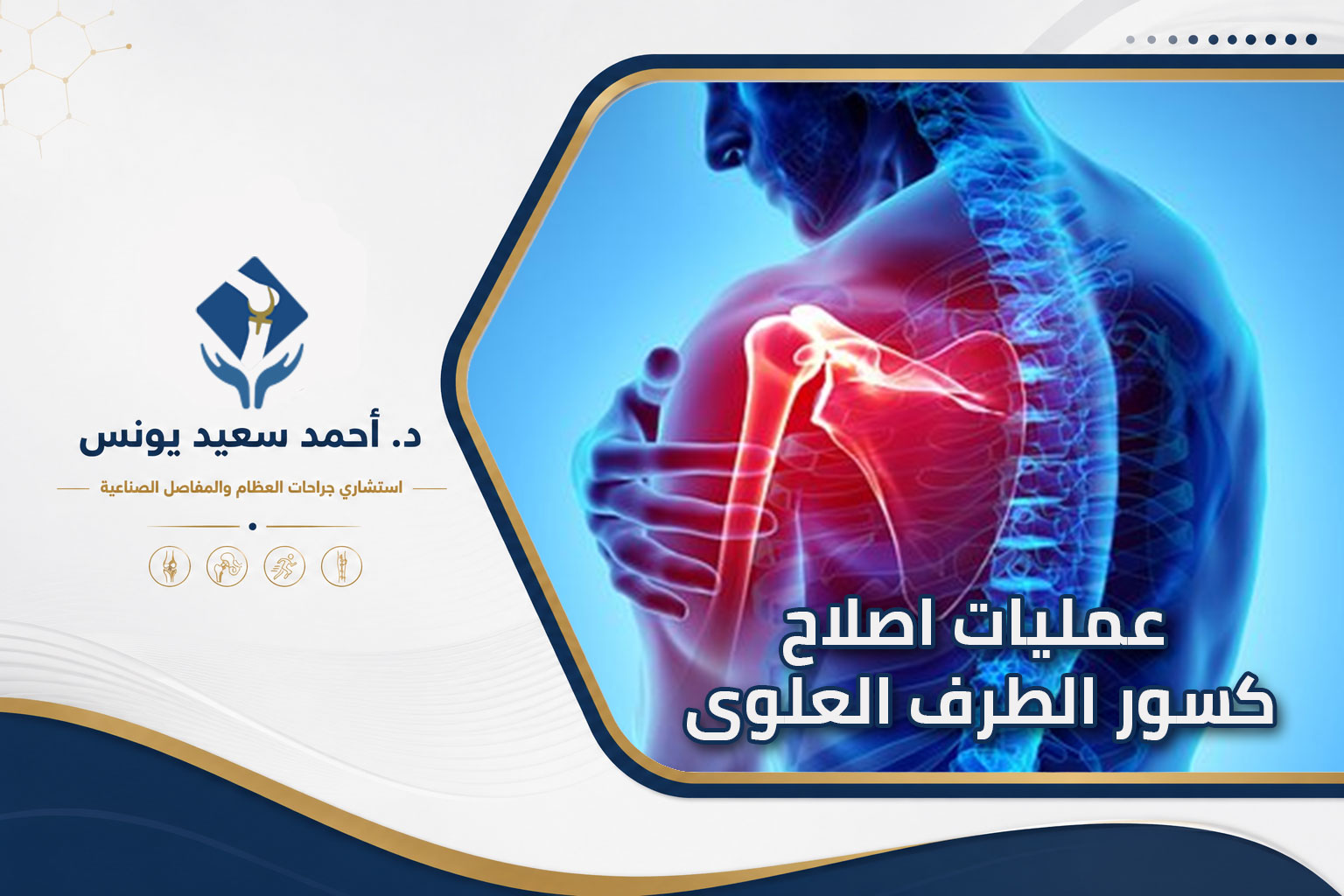 عمليات اصلاح كسور الطرف العلوى