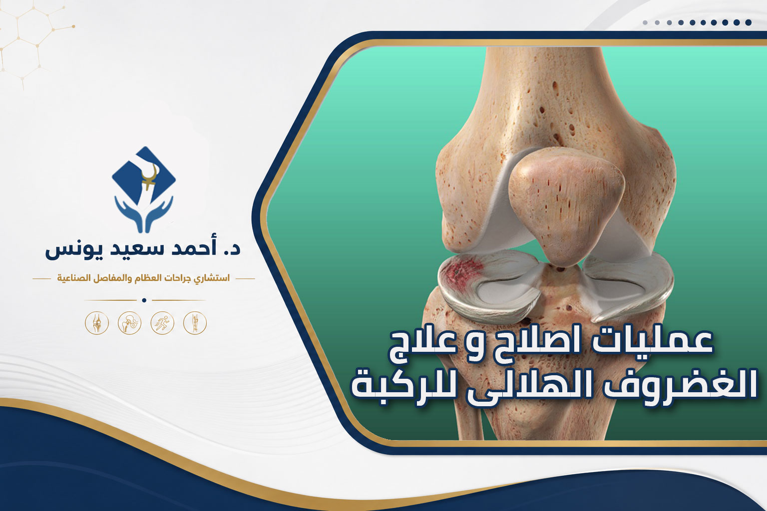 عمليات علاج الغضروف الهلالى للركبة