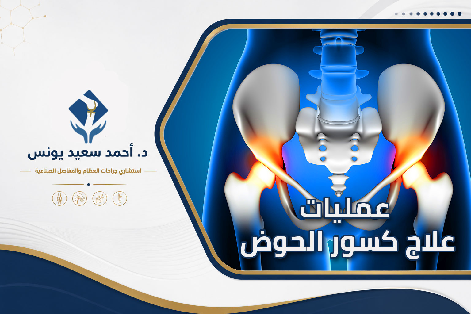 عمليات علاج كسور الحوض