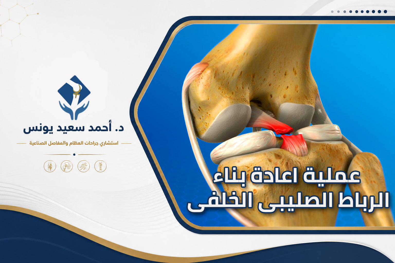 عملية اعادة بناء الرباط الصليبى الخلفى
